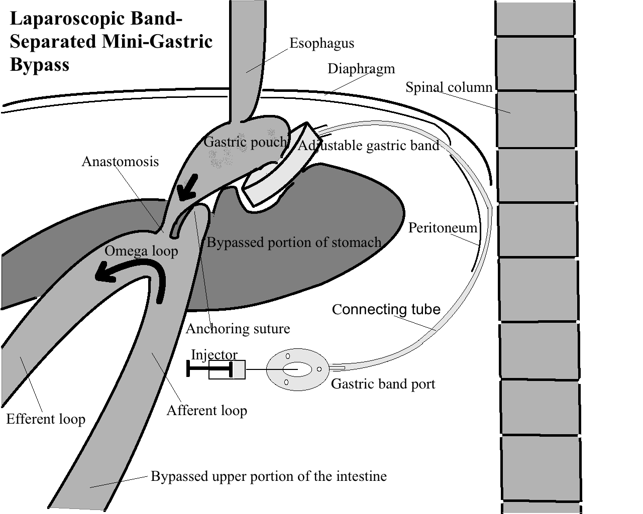 lbsmgb fig.131
